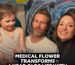 Medical Flower Helps Six-Year-Old With Severe Epilepsy